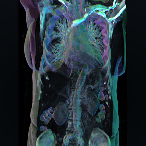 3-D Patient Data Direct from the Clinic